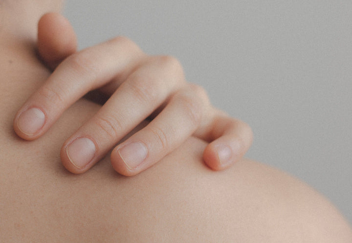 Soigner naturellement son eczéma