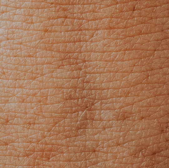 eczema &amp; psoriasis